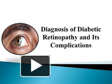 PPT – Diagnosis Of Diabetic Retinopathy And Its Complications ...