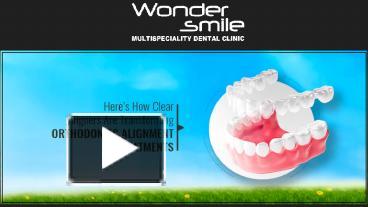 Ppt Heres How Clear Aligners Are Transforming Orthodontic Alignment Treatments Powerpoint