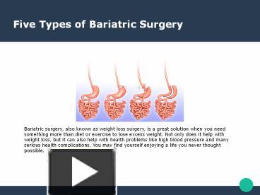 PPT – Five Types Of Bariatric Surgery PowerPoint Presentation | Free To ...