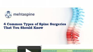 PPT – 4 Common Types Of Spine Surgeries That You Should Know PowerPoint ...