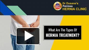 PPT – What Are The Types Of Hernia Treatment? PowerPoint Presentation ...