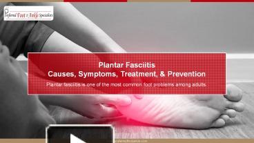 PPT – Plantar Fasciitis Causes, Symptoms, Treatment And Prevention ...