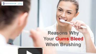 PPT – Reasons Why Your Gums Bleed When You Brush Your Teeth PowerPoint ...