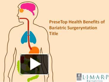 PPT – Top Health Benefits Of Bariatric Surgery PowerPoint Presentation ...