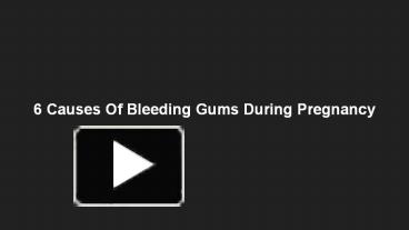 PPT – 6 Causes Of Bleeding Gums During Pregnancy PowerPoint ...