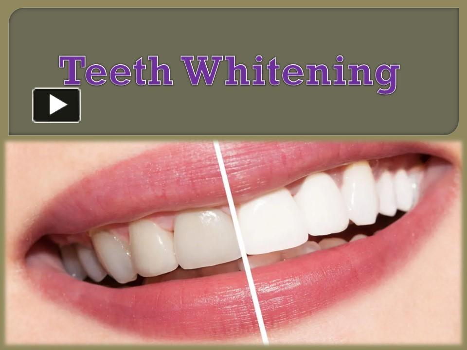 Ppt Teeth Whitening Powerpoint Presentation Free To Download Id