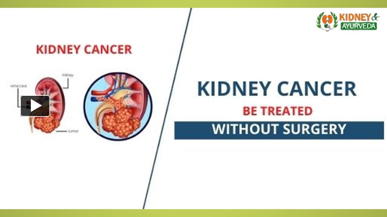 ppt-can-kidney-cancer-be-treated-without-surgery-powerpoint