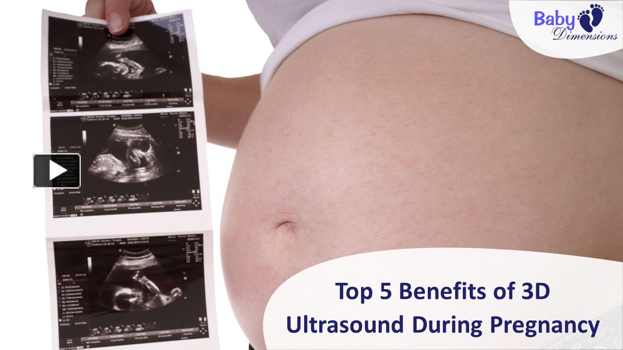 ppt-top-5-benefits-of-3d-ultrasound-during-pregnancy-powerpoint