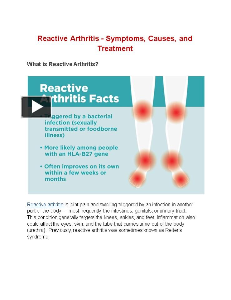 PPT – Reactive Arthritis - Symptoms, Causes, And Treatment PowerPoint ...