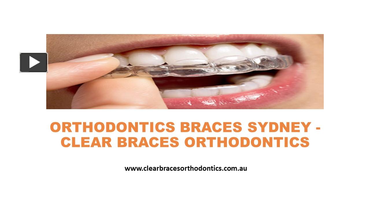 PPT Clear Braces Orthodontics Orthodontics Braces Sydney PowerPoint Presentation Free To