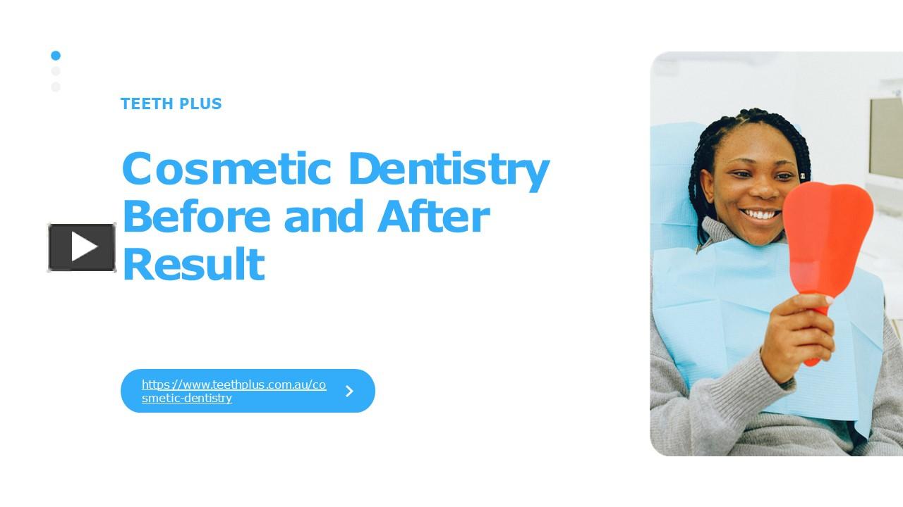 PPT – Best Cosmetic Dentistry Before And After Result At Teeth Plus ...