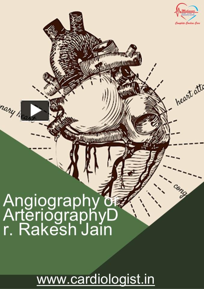 Ppt Angiography Recommendations By Best Cardiologist Dr Rakesh Jain