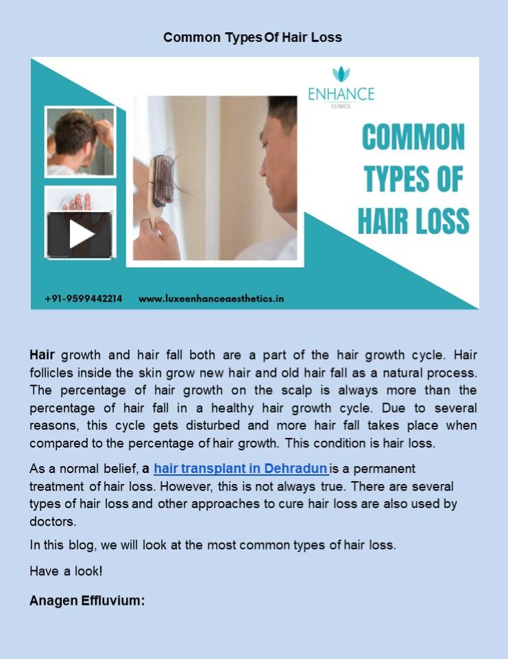 Ppt Common Types Of Hair Loss Powerpoint Presentation Free To