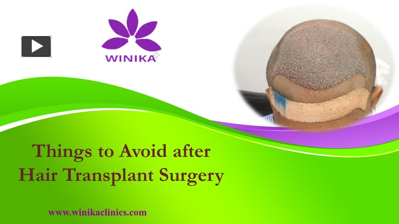 Ppt Things To Avoid After Hair Transplant Surgery Powerpoint