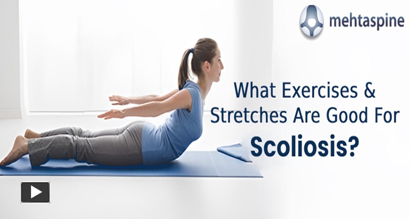 Ppt What Exercises And Stretches Are Good For Scoliosis Powerpoint Presentation Free To