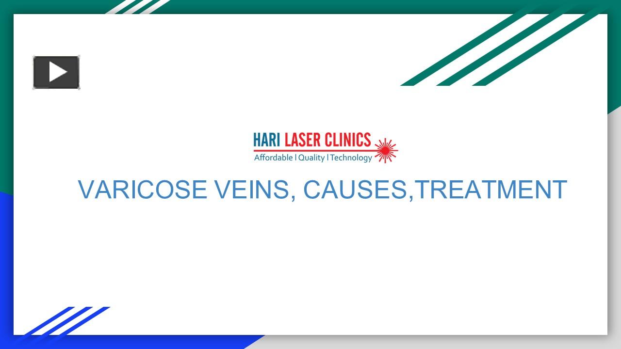 Ppt Varicose Veins Causes Treatment Powerpoint Presentation Free