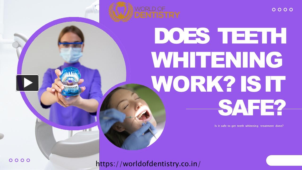 PPT Is It Safe To Get Teeth Whitening Done PowerPoint Presentation Free To Download Id