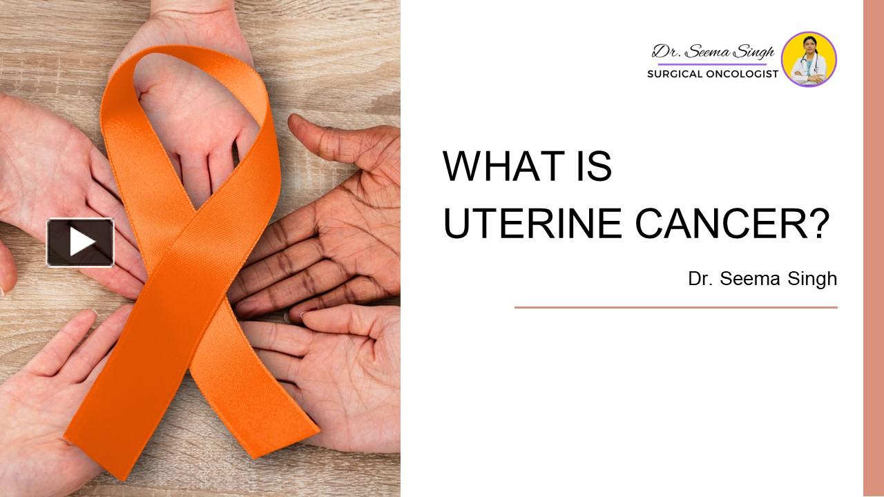 Ppt What Is Uterine Cancer Powerpoint Presentation Free To Download Id 96817c Zdyzm 0675