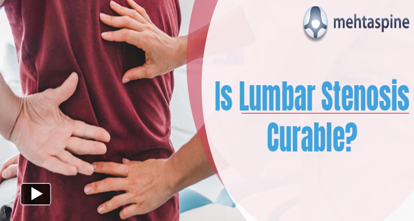 PPT – Is Lumbar Stenosis Curable? Symptoms, Causes, Treatment ...