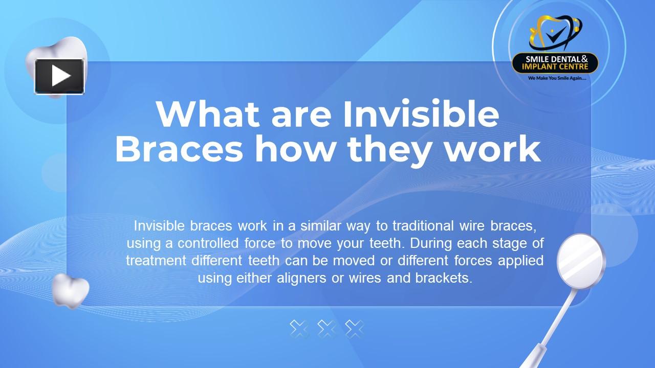 PPT – What Are Invisible Braces How They Work | Smile Dental And ...