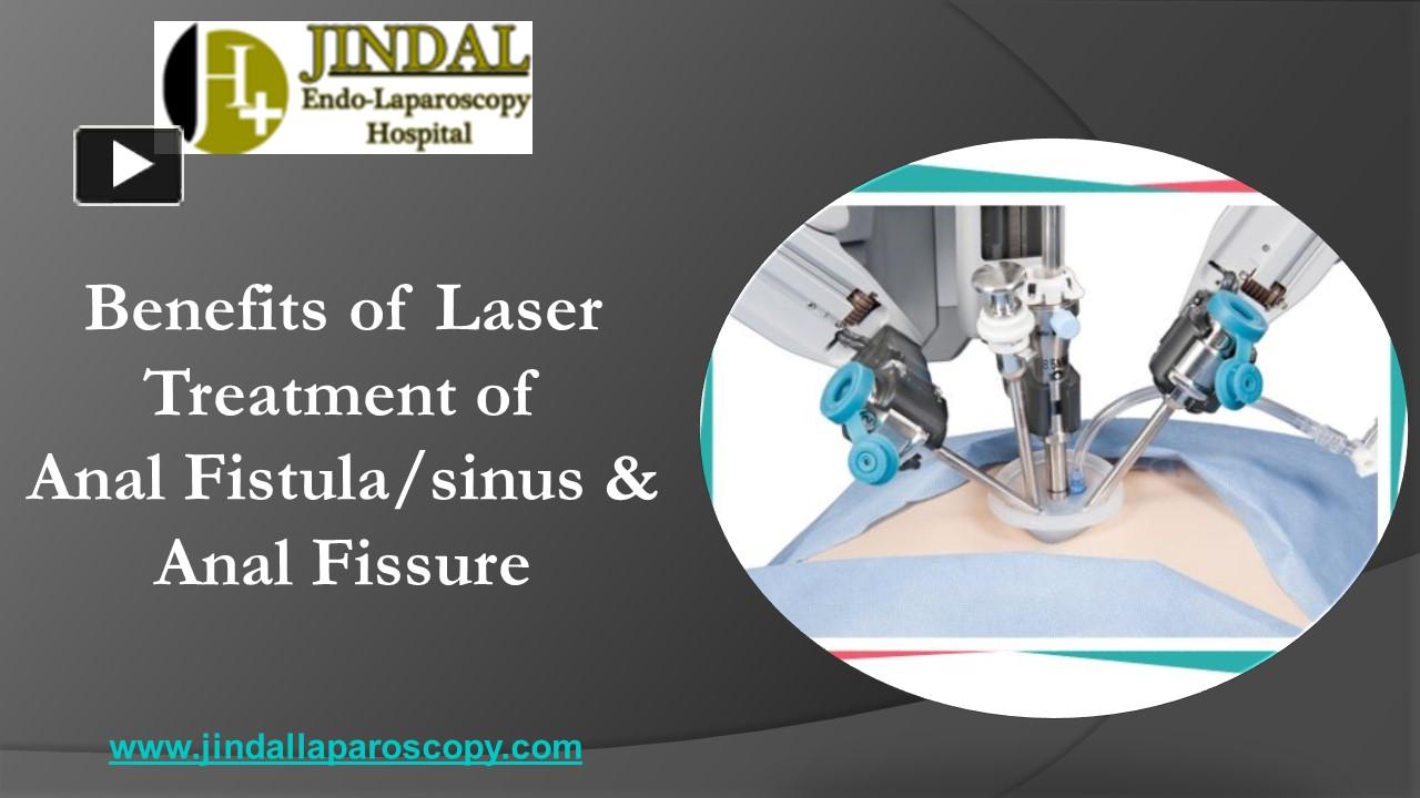 Ppt Benefits Of Laser Treatment Of Anal Fistula Sinus And Anal Fissure