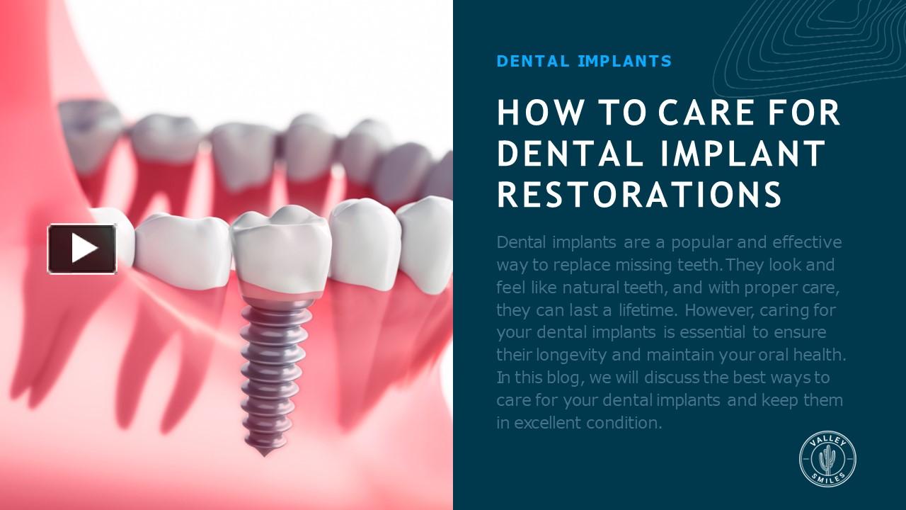 PPT How To Care For Dental Implant Restorations PowerPoint Presentation Free To Download