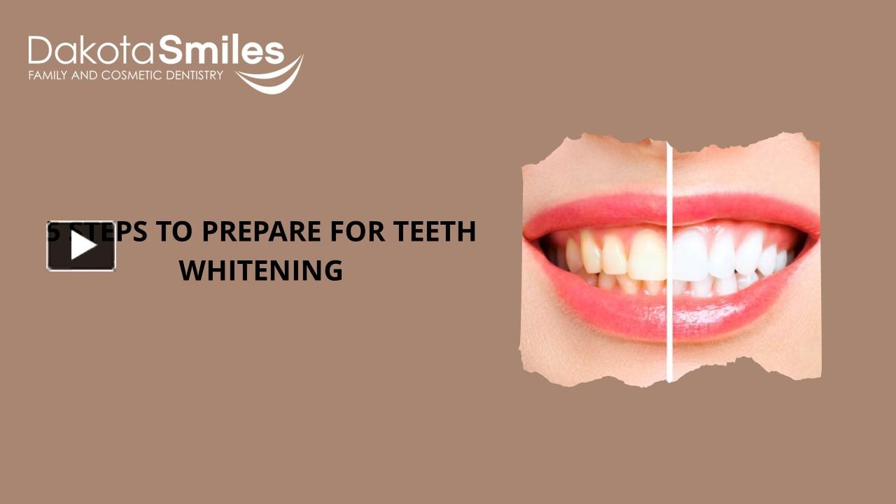 Ppt Top 5 Steps To Prepare For Teeth Whitening Powerpoint