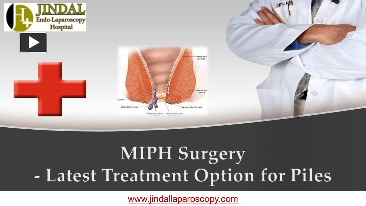 Ppt Miph Surgery Latest Treatment Option For Piles Powerpoint Presentation Free To 6020