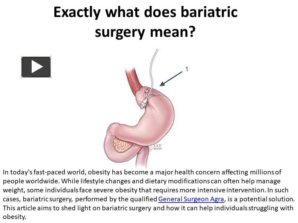 Ppt What Does Bariatric Surgery Include Specifically Powerpoint