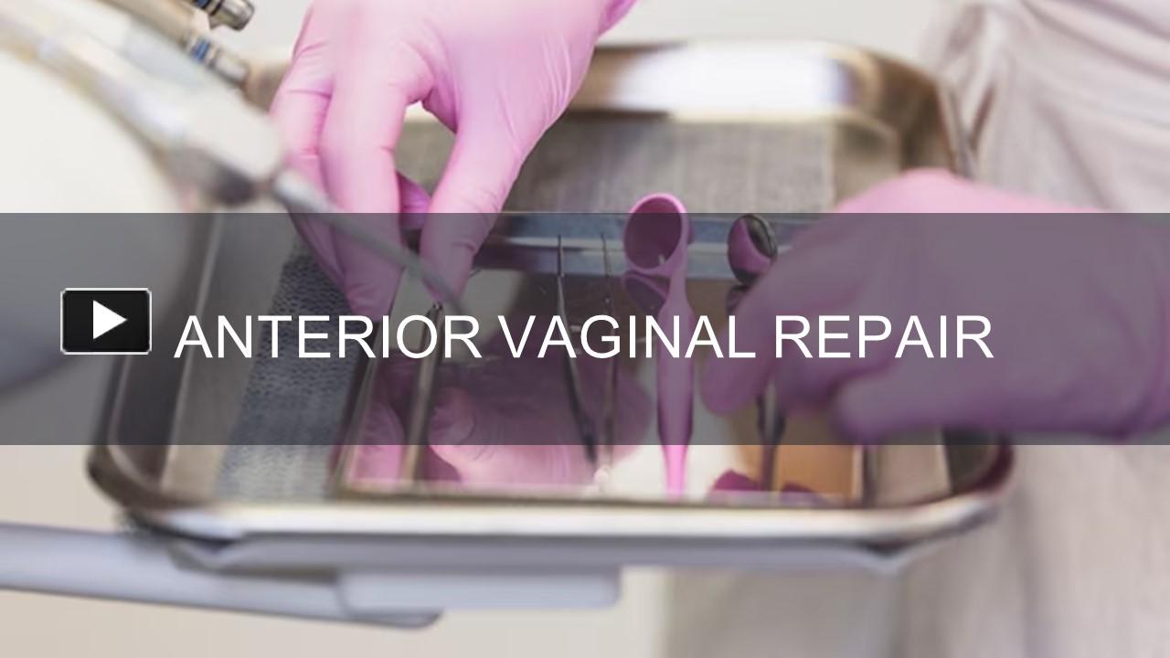 PPT Anterior Vaginal Repair PowerPoint Presentation Free To