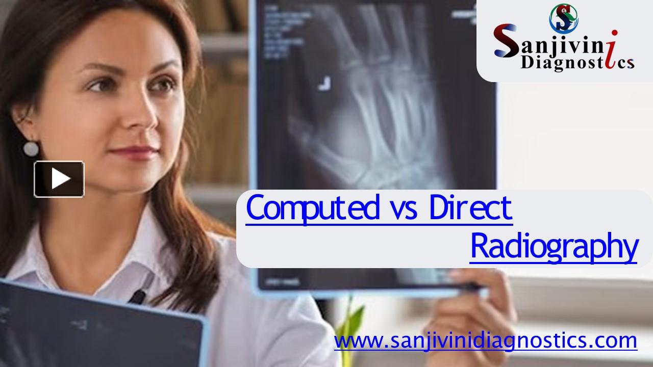 Ppt A Radiographic Showdown Comparing Computed And Direct