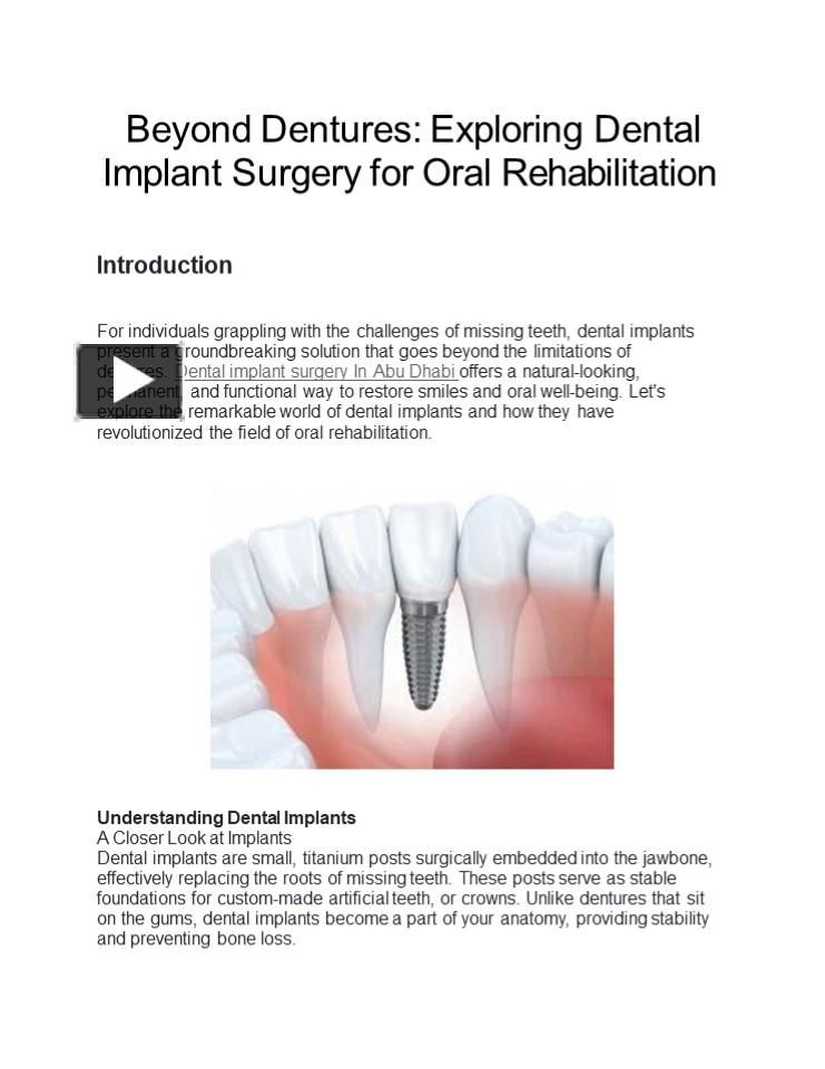 Ppt Beyond Dentures Exploring Dental Implant Surgery For Oral Rehabilitation Powerpoint