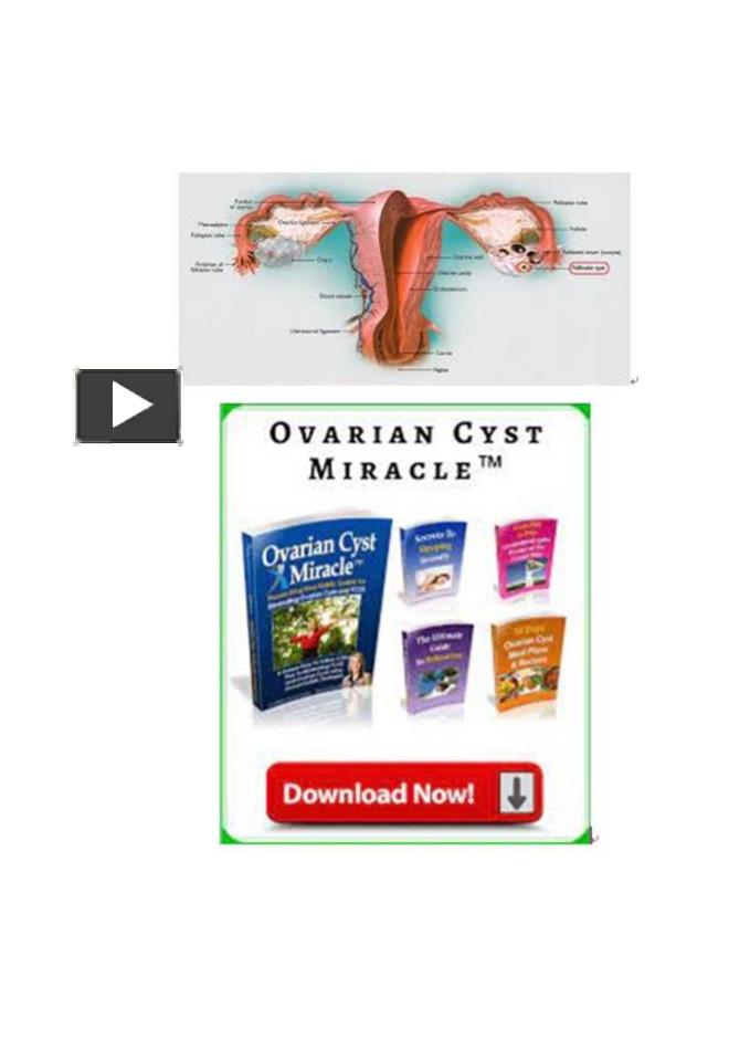 Ppt Ovarian Cyst Miracle Pdf Manual And Guide Ebook Download Powerpoint