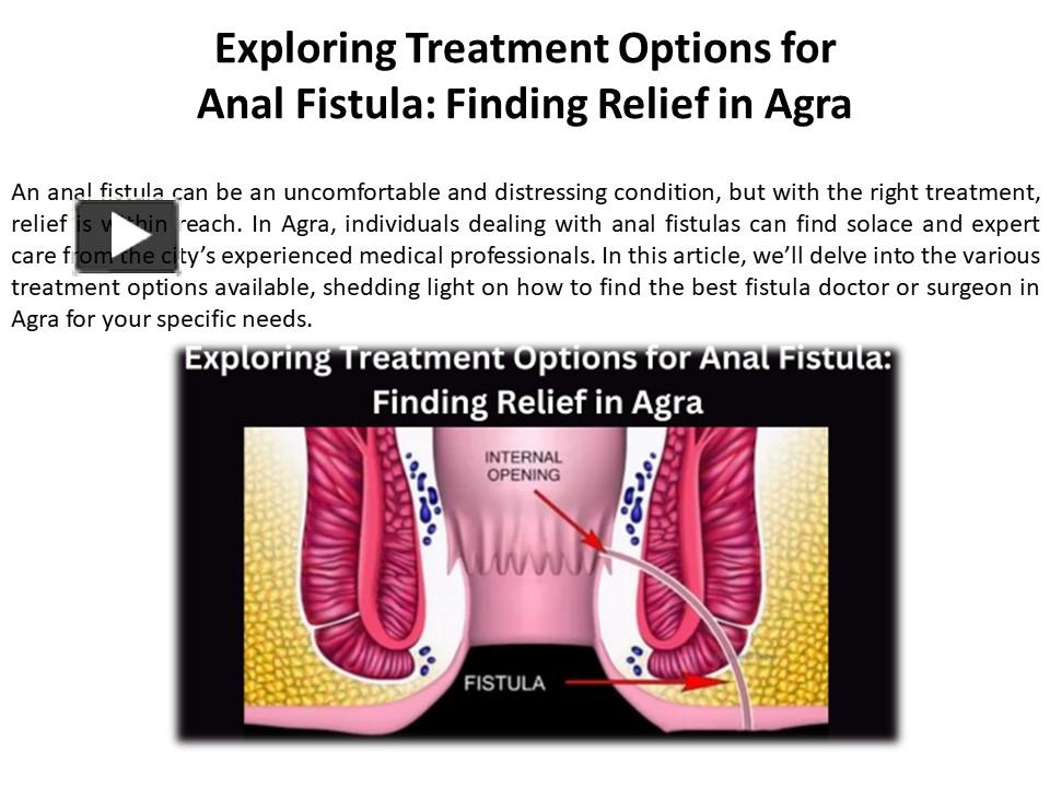 Ppt Getting Anal Fistula Treatment In Agra Powerpoint Presentation