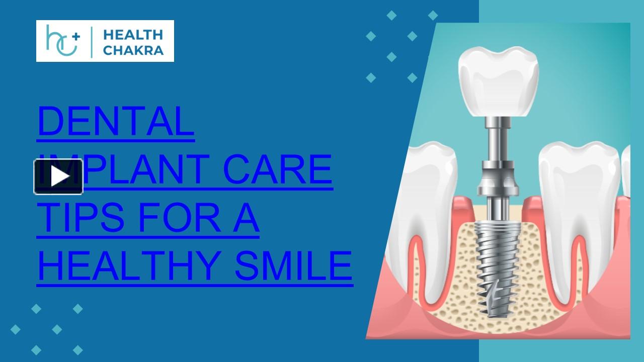 Ppt Dental Implant Care Tips For A Healthy Smile Ppt Powerpoint Presentation Free To