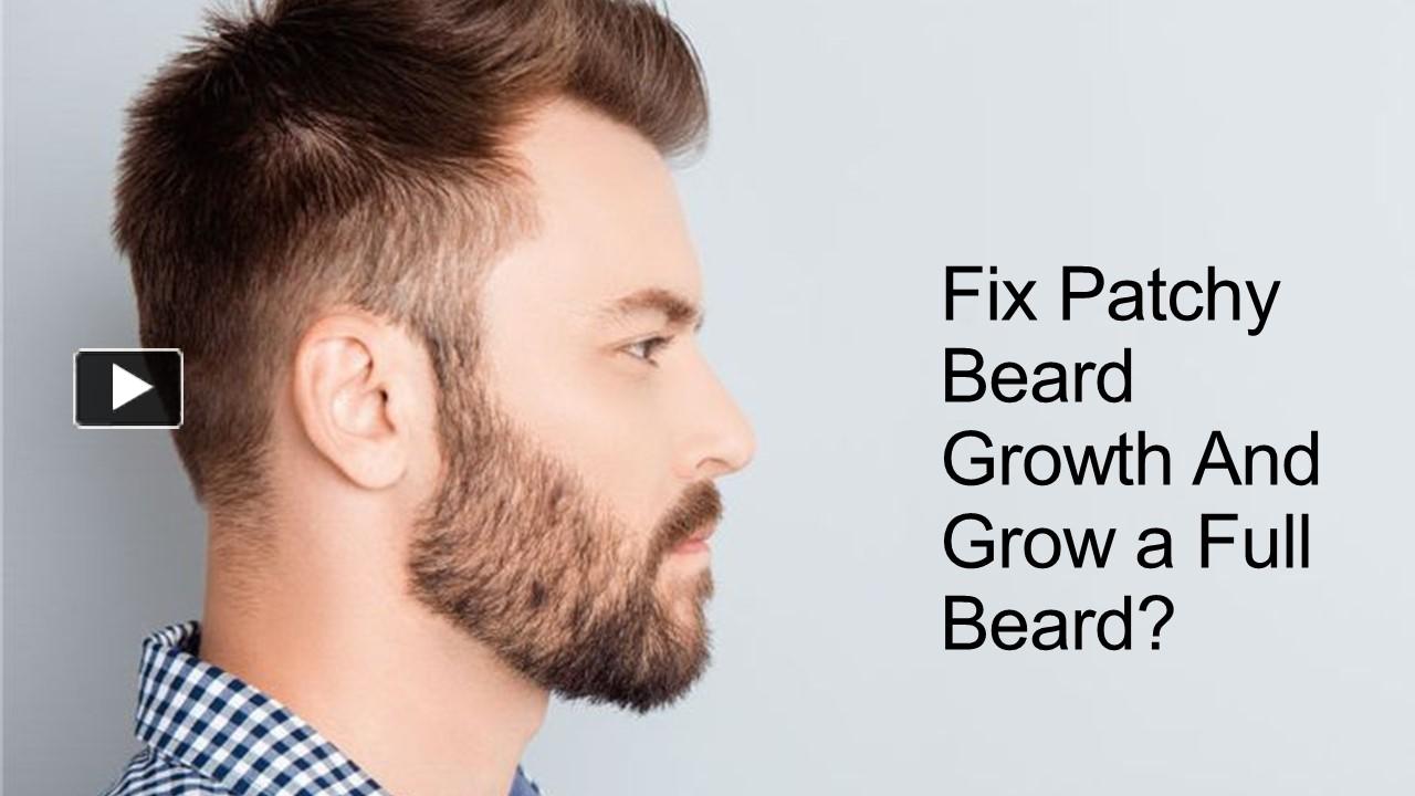 Ppt Fix Patchy Beard Growth And Grow A Full Beard Powerpoint