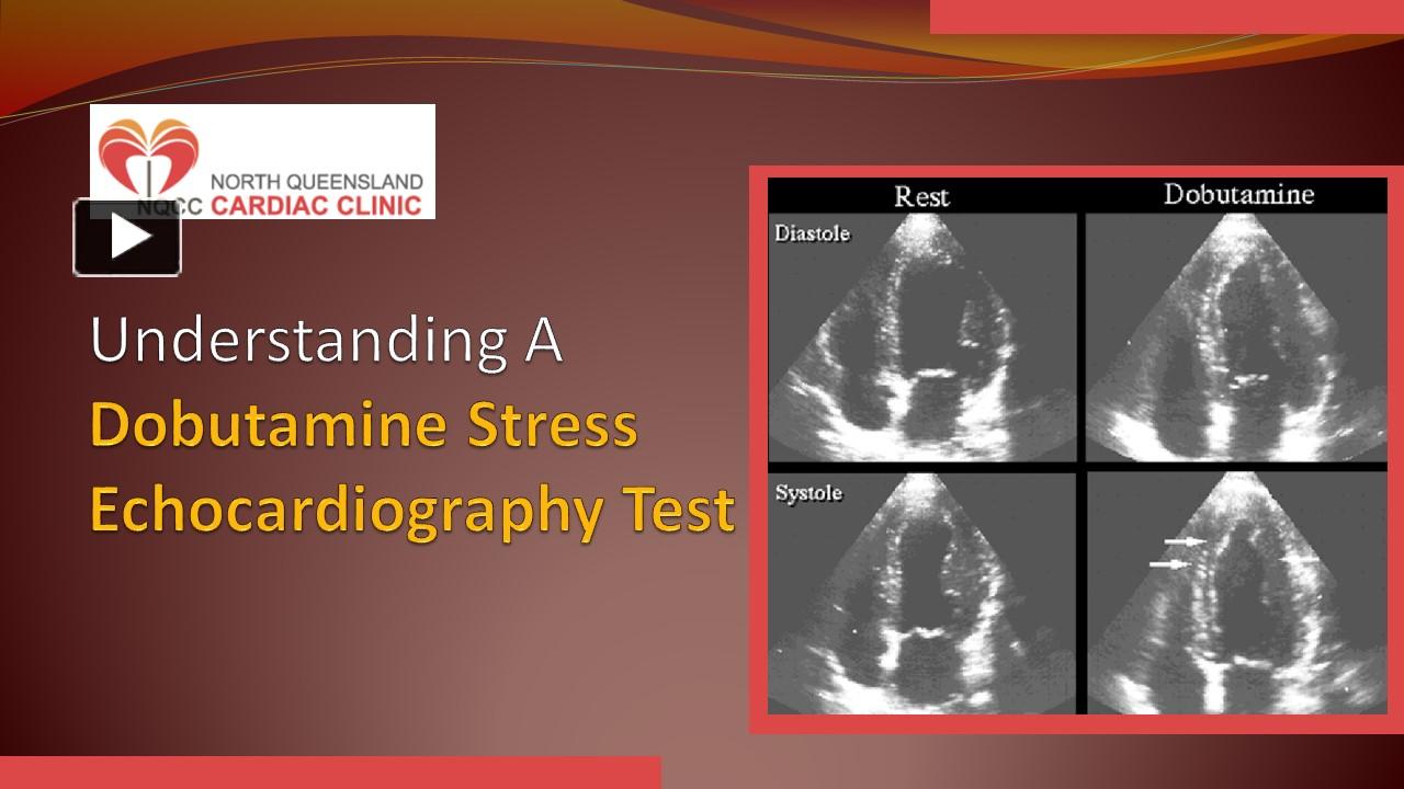 PPT – Understanding A Dobutamine Stress Echocardiography Test ...