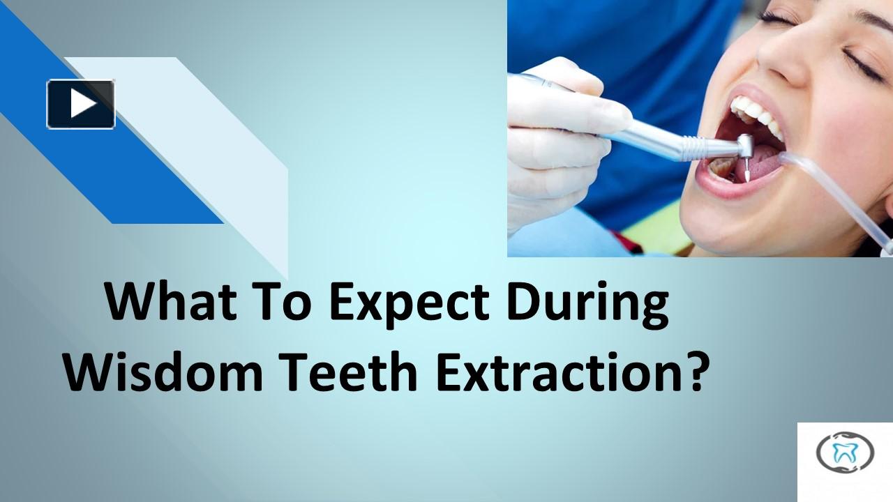 Ppt What To Expect During Wisdom Teeth Extraction Powerpoint Presentation Free To Download 5552