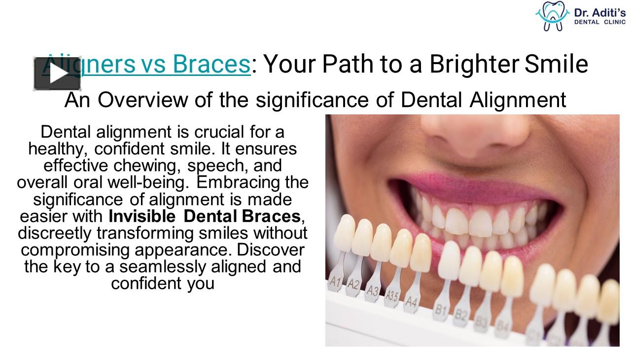 Ppt Aligners Vs Invisible Dental Braces Clear And Convenient