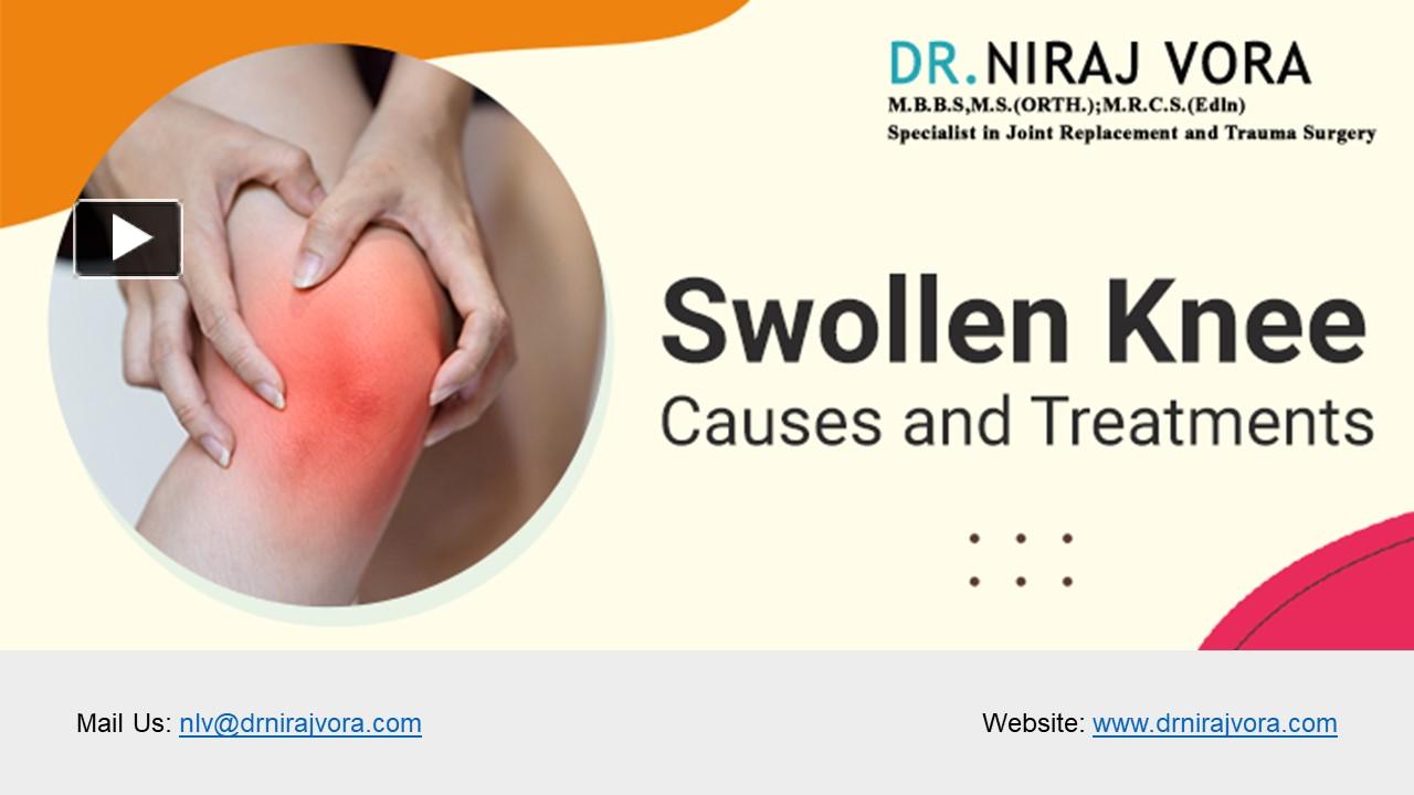 Ppt Swollen Knee Causes And Treatment Dr Niraj Vora Powerpoint