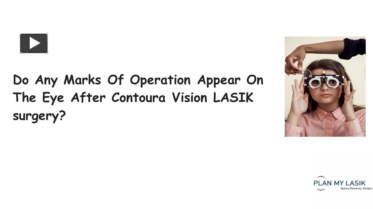 PPT Do Any Marks Of Operation Appear On The Eye After Contoura Vision