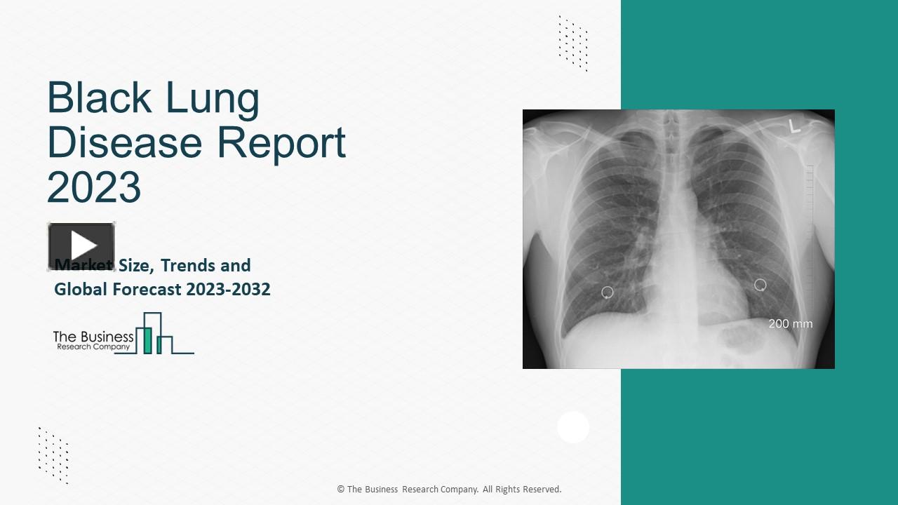 PPT Black Lung Disease Market Size, Share, Growth Factors And Trends