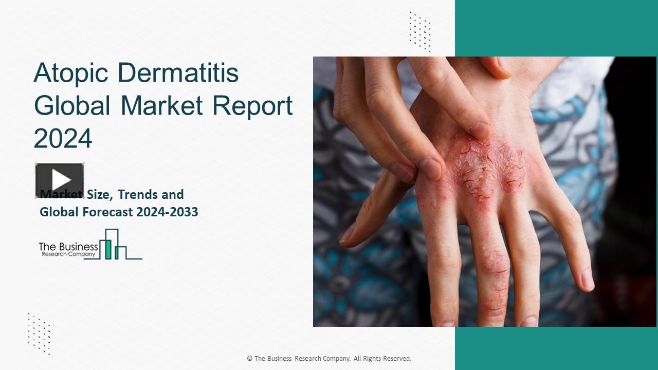 Ppt Atopic Dermatitis Market Growth Trajectory Through 2024 2033 Powerpoint Presentation 3028