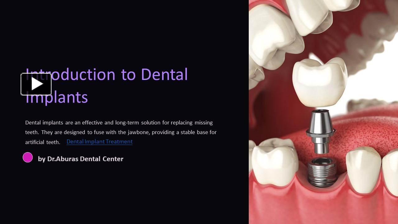 PPT – Dental Implant Treatment PowerPoint Presentation | Free To ...