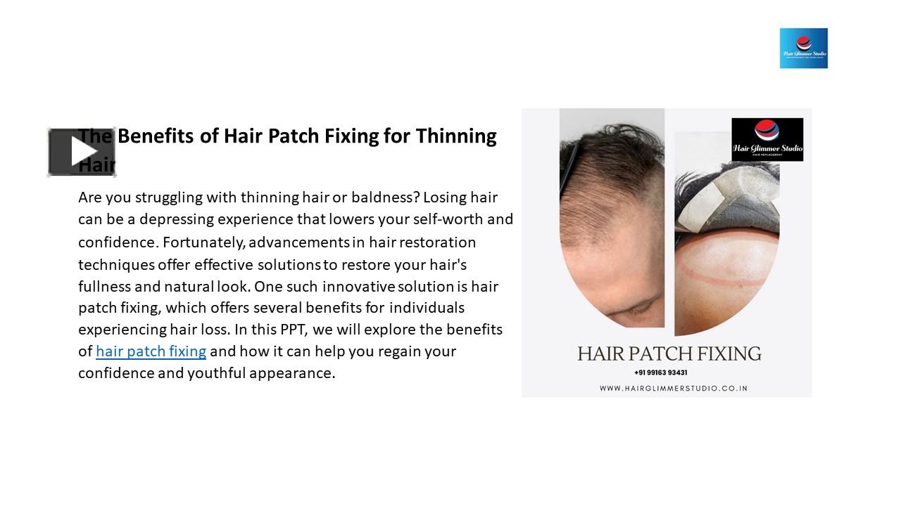 Ppt The Benefits Of Hair Patch Fixing For Thinning Hair Powerpoint Presentation Free To 3363