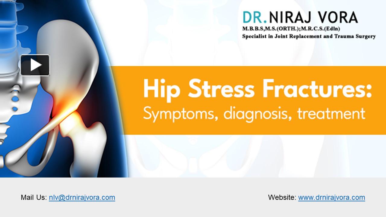 Ppt Hip Stress Fractures Symptoms Diagnosis And Treatment Dr Niraj Vora Powerpoint 0287