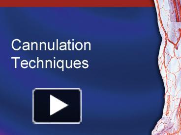 Ppt Cannulation Techniques Powerpoint Presentation Free To View Id 0db Mjbmm