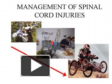 PPT – MANAGEMENT OF SPINAL CORD INJURIES PowerPoint Presentation | Free ...