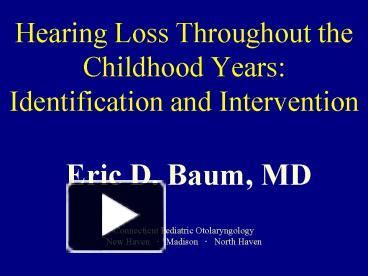 PPT – Hearing Loss Throughout The Childhood Years: Identification And ...