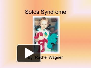 PPT – Sotos Syndrome PowerPoint presentation | free to view - id ...